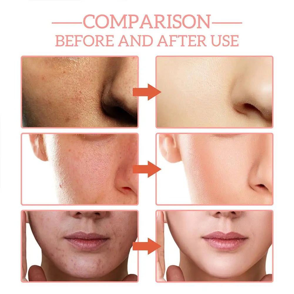 5-in-1 Anti-Aging & Firming Facial Serum
